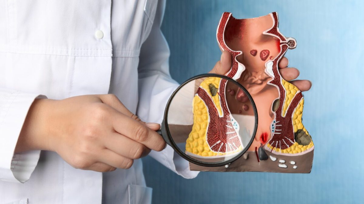 proctologia-1-1200x675.jpg